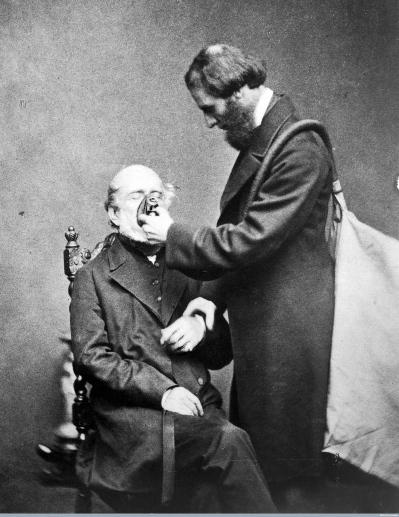 L0018240 Anaesthetics: J.T. Clover Credit: Wellcome Library, London. Wellcome Images images@wellcome.ac.uk http://wellcomeimages.org J.T. Clover administering of chloroform Published: - Copyrighted work available under Creative Commons Attribution only licence CC BY 4.0 http://creativecommons.org/licenses/by/4.0/